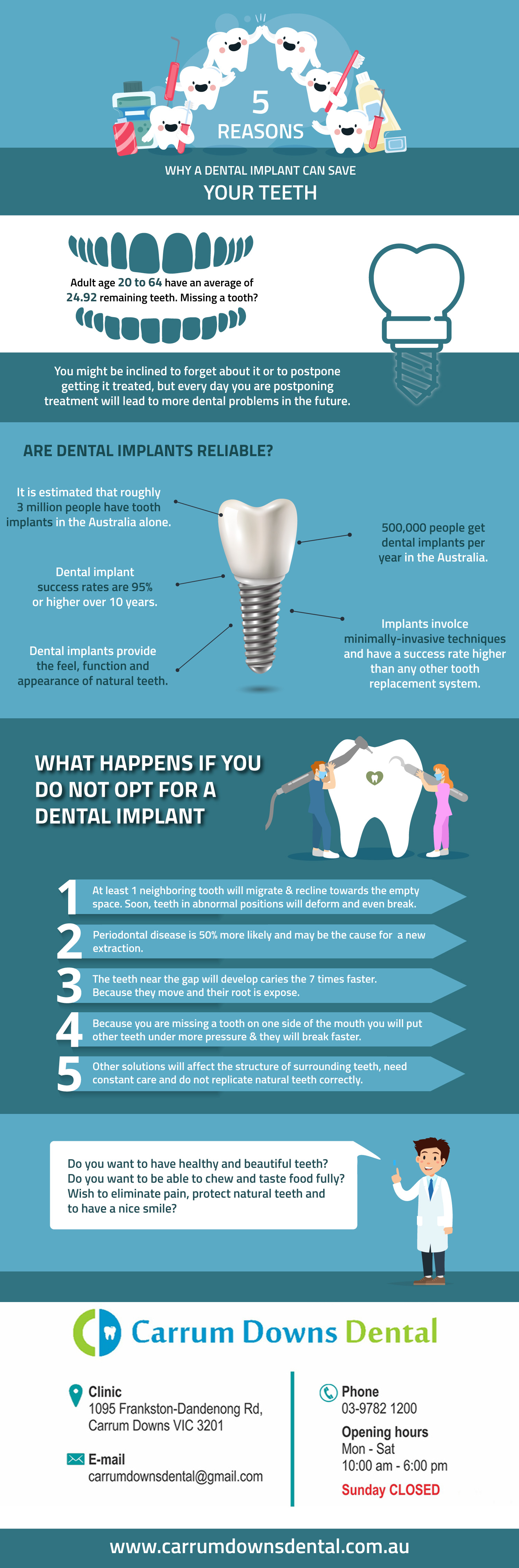 Dental Implant