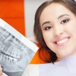 Teeth Implants Carrum Downs