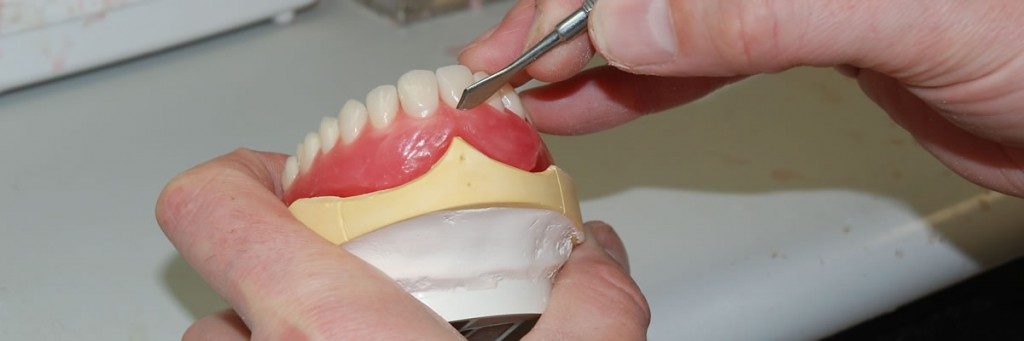 All You Need to Know About Denture Repairs