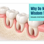 Why Do We Have Wisdom Teeth? Issues And Solutions