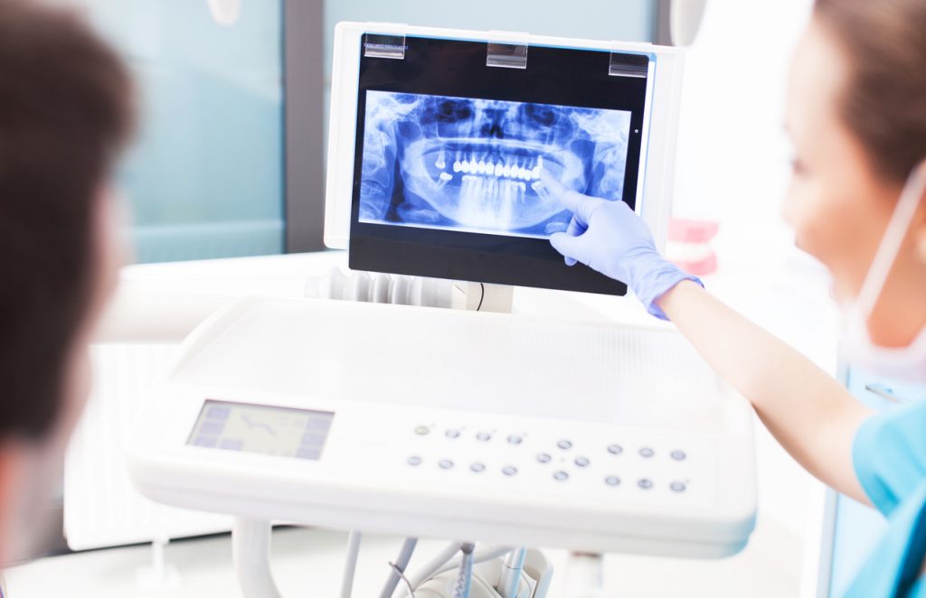 Root Canal X-rays Carrum Downs