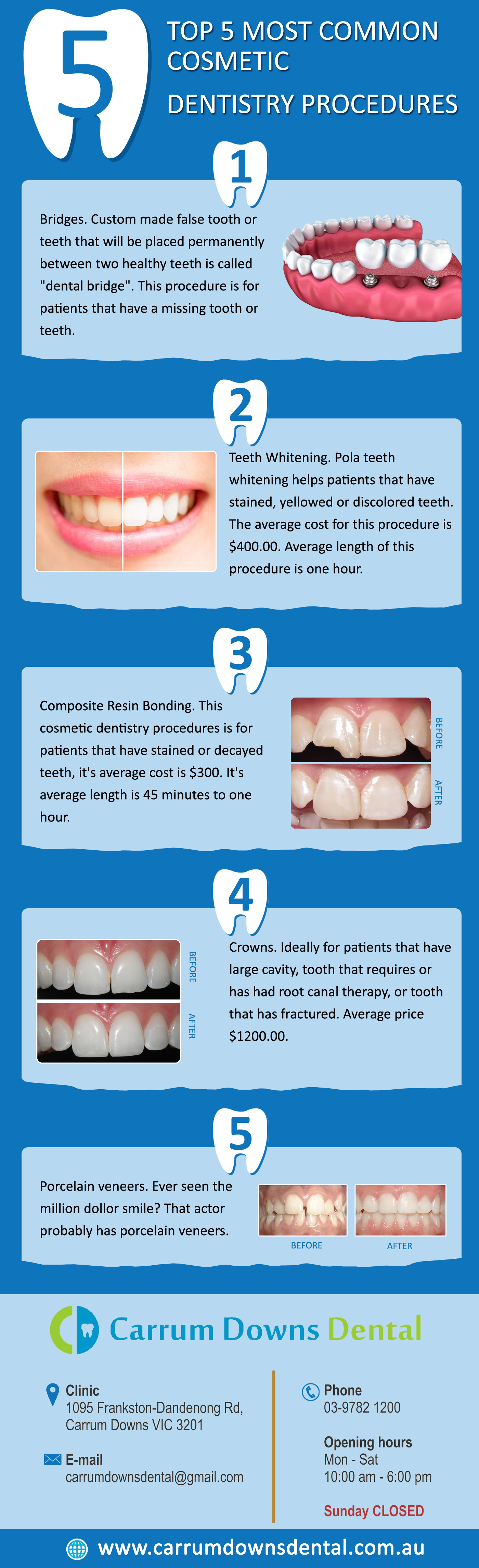 Transform Your Smile with Advanced Cosmetic Dental Treatments