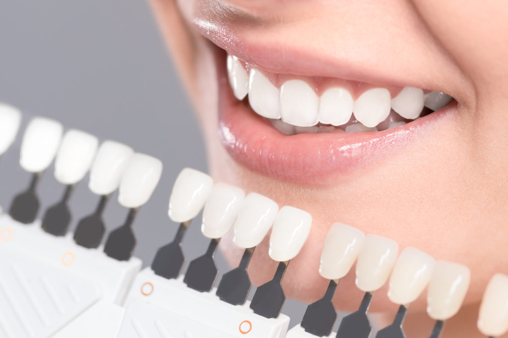 Teeth whitening methods and aftercare