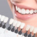 Teeth whitening methods and aftercare