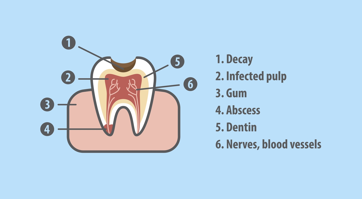 FAQ - Root Canal