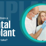 Dental Implant