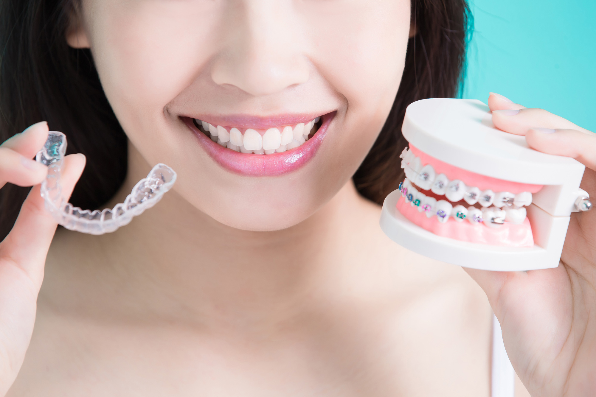 Dental braces