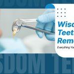 Wisdom Teeth Removal