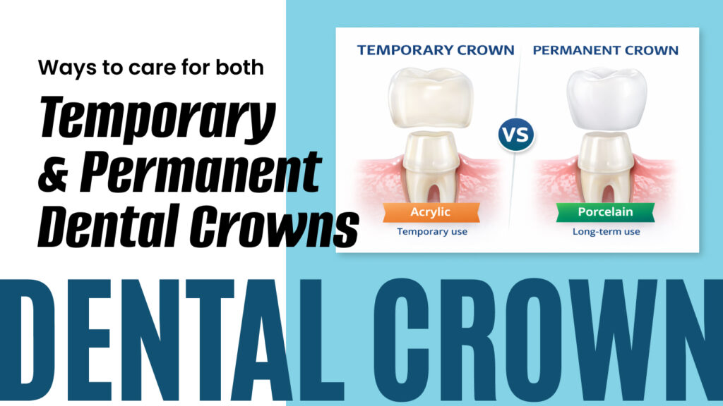 Ways to care for both temporary and permanent dental crowns