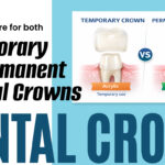 Ways to care for both temporary and permanent dental crowns