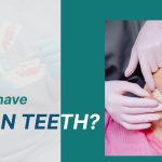 Clean Teeth