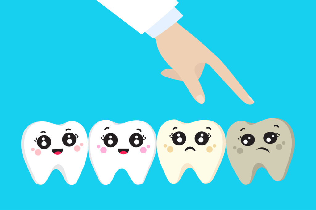 Wisdom Tooth Extraction