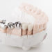 Bridged dental prostheses