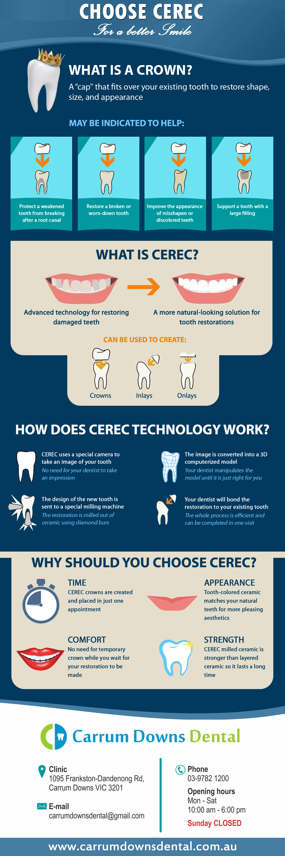 Choose Cerec - Dental Infographics