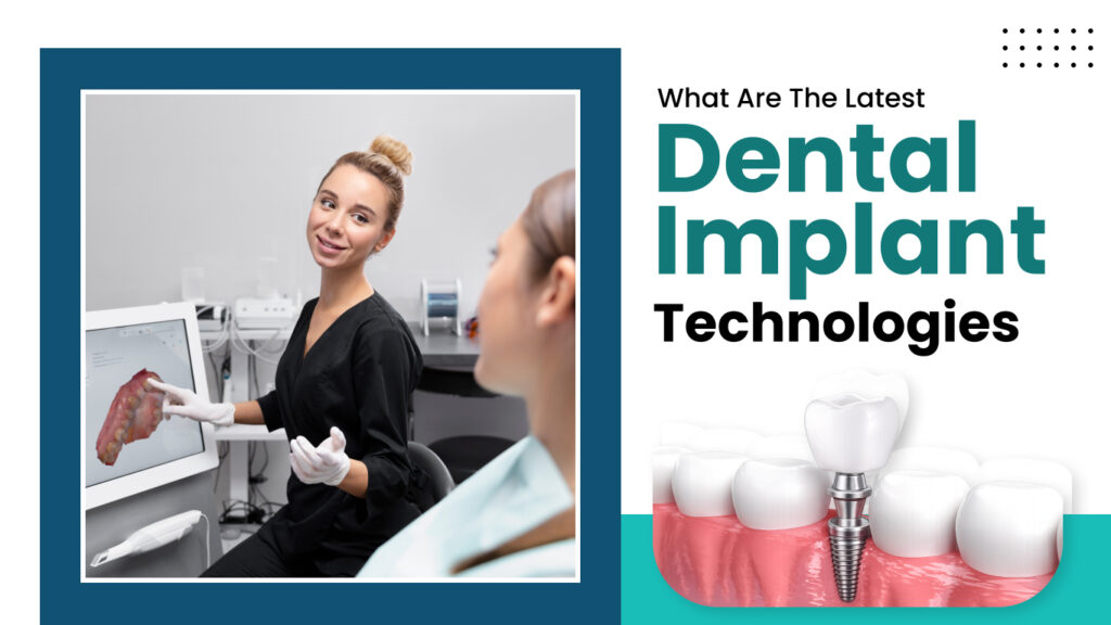 What Are The Latest Dental Implant Technologies