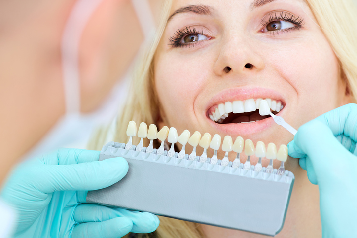 Dental Veneers carrum downs