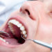 Dental Emergency - Carrum Downs Dental