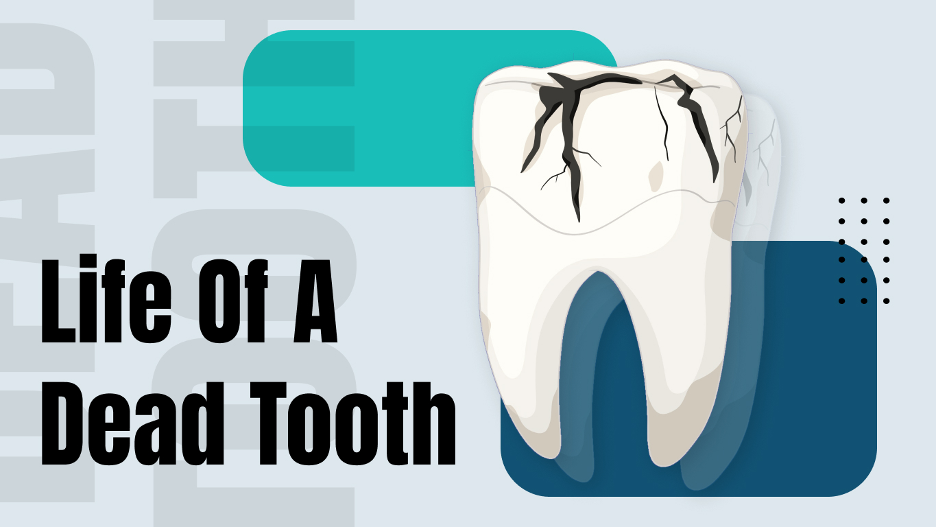 Dead Tooth