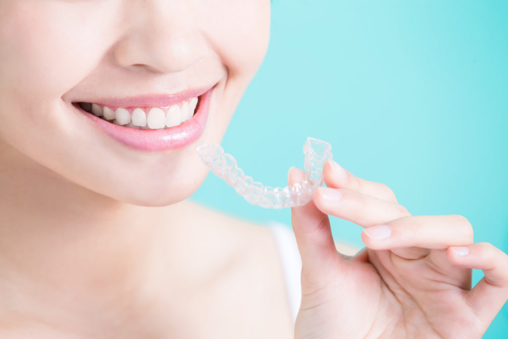 invisible braces - Teeth Aligners