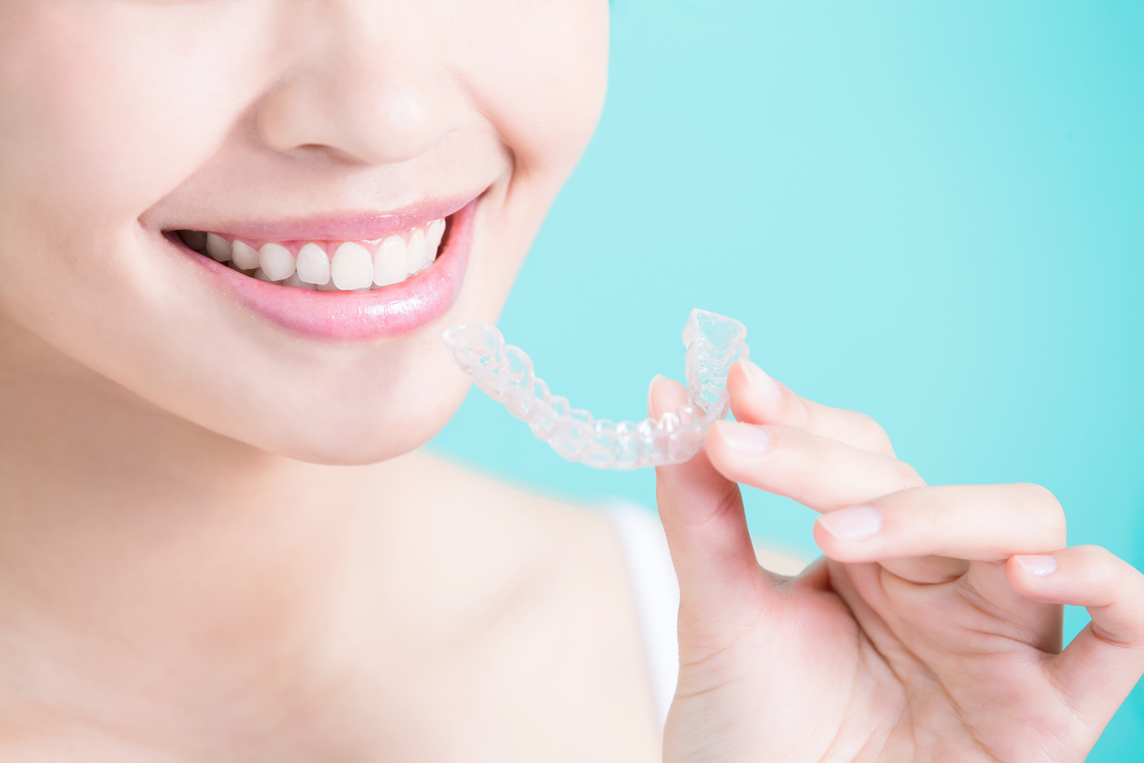 Things You Should Know Before Getting Invisible Braces