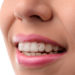 Why is Clear Aligners the best choice?  How to clean, clearcorrect aligners?