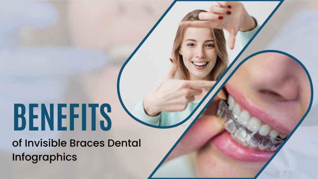 Invisible-Braces