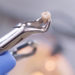 Know The Wisdom Teeth Removal Procedure and Complications