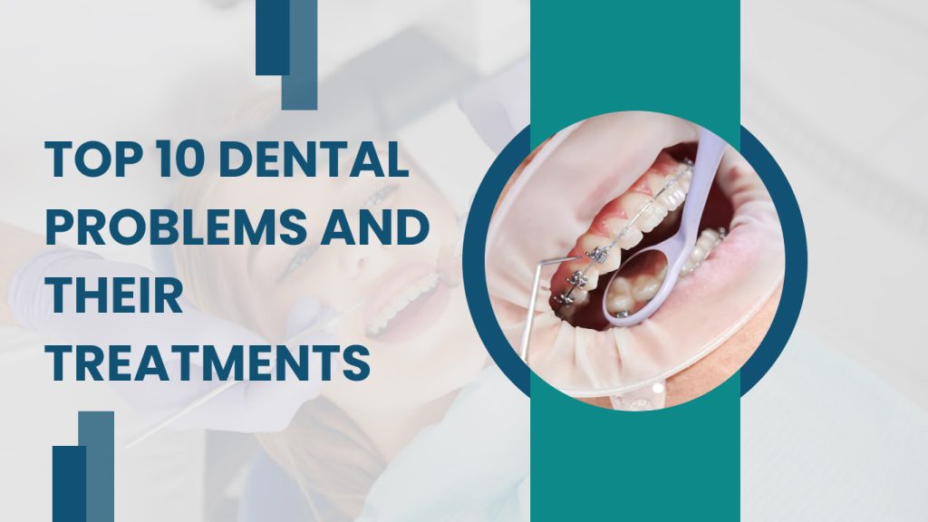 Dental Problems