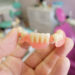 Partial Dentures