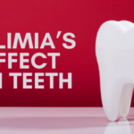 Bulimia effect on teeth