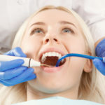 Dentist Root Canal