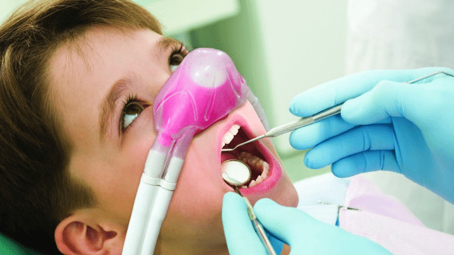 Nitrous Oxide in Dentistry