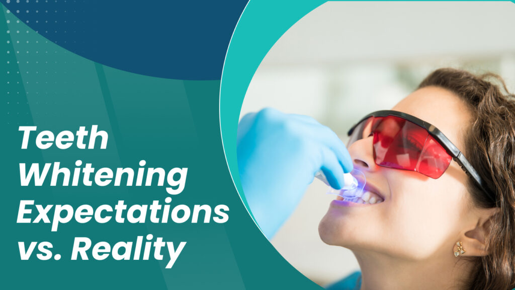 Teeth Whitening Expectations vs. Reality