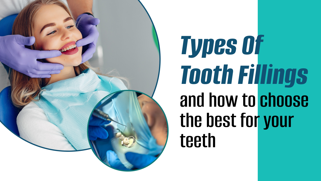 Type of tooth filling