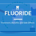 Fluoride Treatment