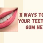 Heathy Teeth and Gums Tips