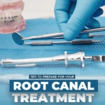 Root Canal Treatment Tips