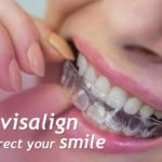 Invisalign can correct your smile