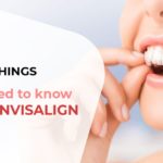 Top 5 things you need to Know about Invisalign