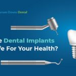 dental implant carrum downs dental