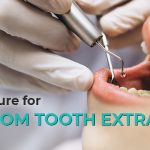 Procedure for Wisdom Tooth Extraction