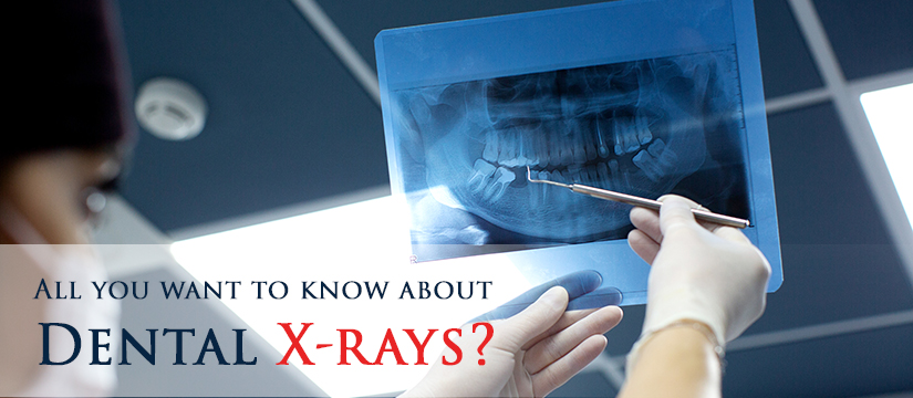 dentist checks x ray photo of mouth