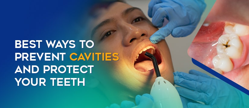 Prevent Cavities and Protect Your Teeth