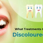 What Treatments can Help with Discoloured Teeth