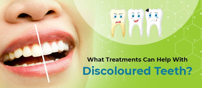 What Treatments can Help with Discoloured Teeth