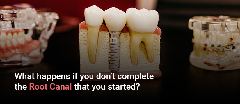 What happens if you dont complete the root canal that you started