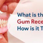 What is the Gum Recession and How is it Treated?