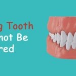 A Missing Tooth Should Not Be Ignored