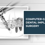 Computer-Guided Dental Implant Surgery