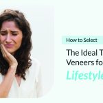 How to Select the Ideal Types of Veneers for Your Lifestyle